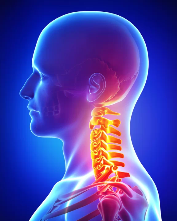 أفضل علاج لديسك الرقبة